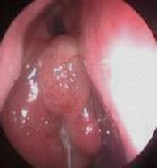 ԭҽ�����������Ա������ͣ�֢״���֣�