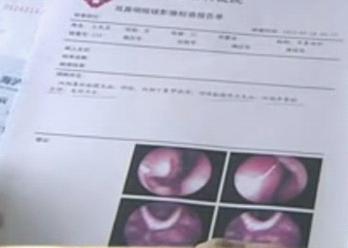 �������ʧ����Ͱ������