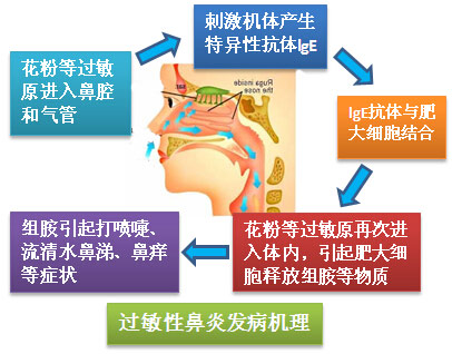 过敏性鼻炎过敏怎么办?及时就医90%的人可临床治愈