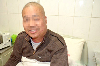 老中医确诊鼻咽癌,幸得中大专家准确救治