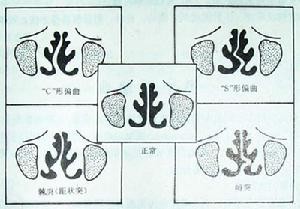 ԭ����ҽ����⣺���и�ƫ����Ҫ֢״����Щ��